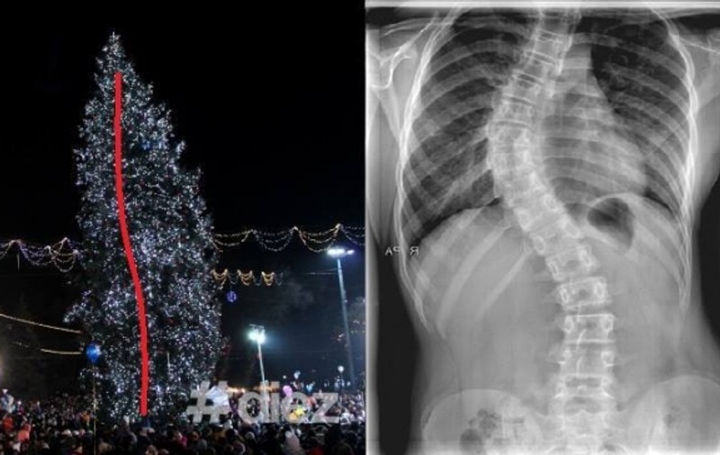 A comis-o și a recunoscut! Primarul Chișinăului și-a cerut scuze pe Facebook pentru bradul de anul acesta