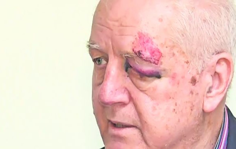 Jean Pădureanu, şeful Gloriei Bistriţa, a fost agresat şi jefuit ieri în Bucureşti, înaintea meciului cu Steaua. I-a umflat ochiul lui «tata Jean»
