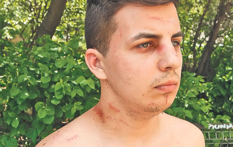 Tânărul bătut de poliţişti va fi tratat de psihologi! Adrian Hîrdău susţine că trei agenţi l-au încătuşat şi l-au călcat în picioare