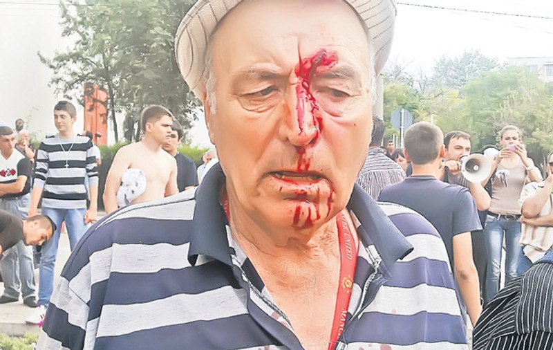 Un pensionar din Năvodari, snopit în bătaie de susţinătorii unui candidat