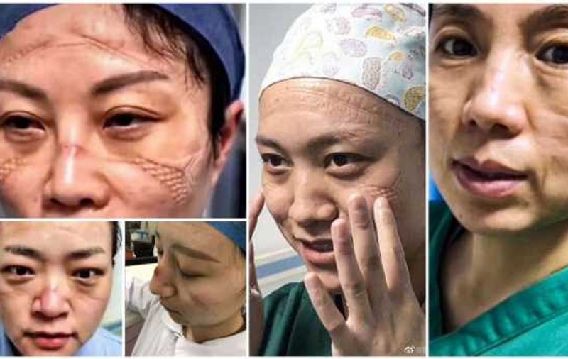 Imagini șocante în China: medicii care luptă cu virusul sunt plini de răni, poartă scutece şi dorm pe holurile spitalelor