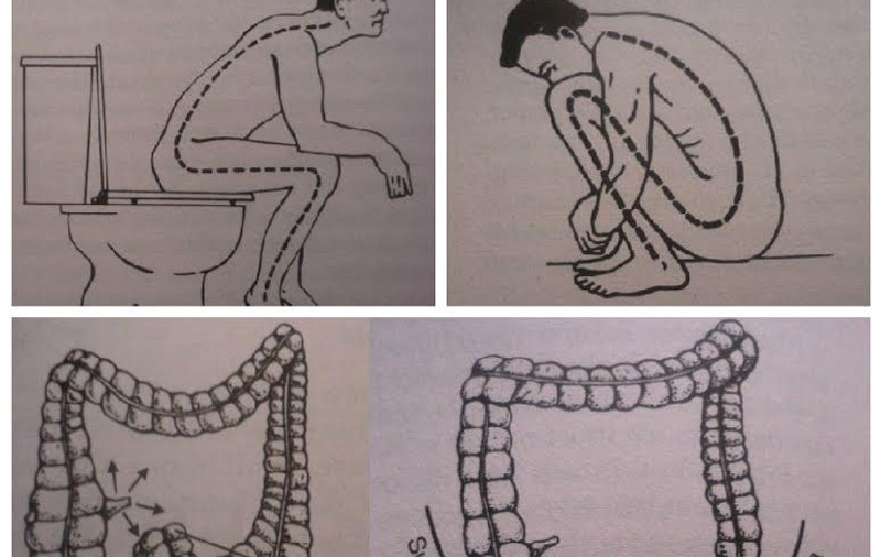 PE CÂT PARIU CĂ NU STAI CORECT PE WC? AFLĂ ADEVĂRUL DESPRE FOLOSIREA TOALETEI