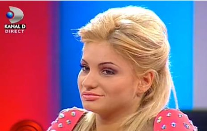 Foto | Emmy şi-a injectat acid hialuronic în buze