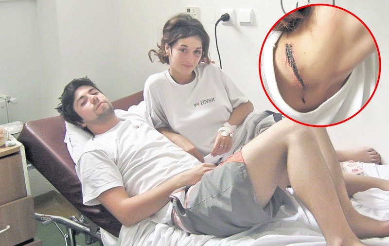 Doi studenţi au supravieţuit după ce au fost fulgeraţi: "Trăsnetul mi-a topit lănţişorul"