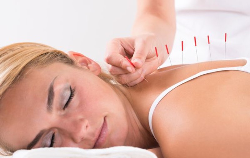 Ce afecțiuni tratează acupunctura