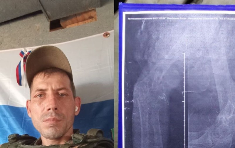 Foștii prizonieri ruși de război răniți sunt trimiși înapoi la luptă: „Am un glonț în mine și mâna fracturată în multe locuri. Suntem schilozi pe frontul din Donețk”