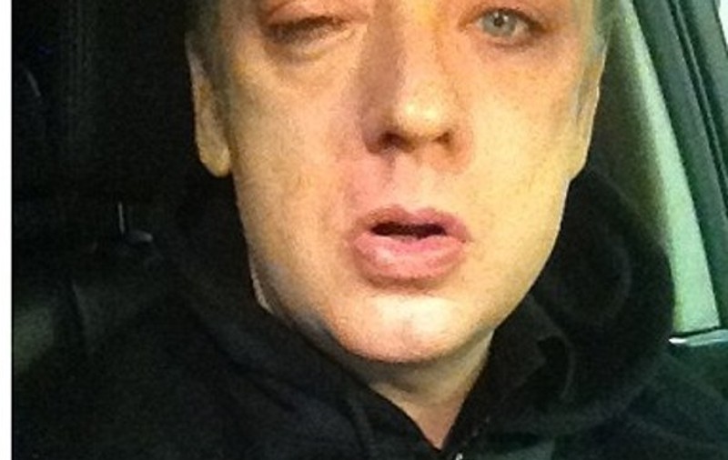 Boy George, cu ochiul învinețit de o ... femeie! FOTO