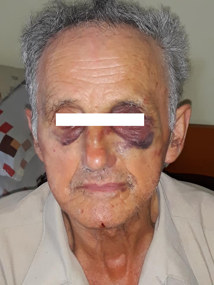Un bătrân de 78 de ani ar fi fost bătut în Spitalul din Sighetu Marmației. Directorul a declanșat o anchetă dar e posibilă și o confuzie