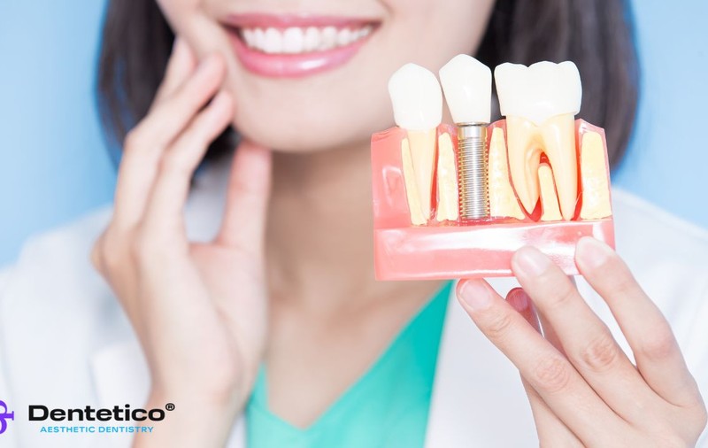 Ghid complet pentru îngrijirea dinților după un implant dentar
