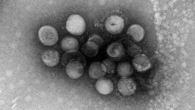 Virusul care a infectat cei 8 copii din Malaezia | FOTO: Ohio State University via Science