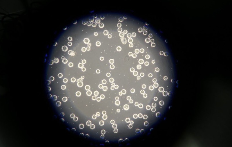 Distrugerea „celulelor zombi” din vasele de sânge ar ajuta tratamentul împotriva diabetului