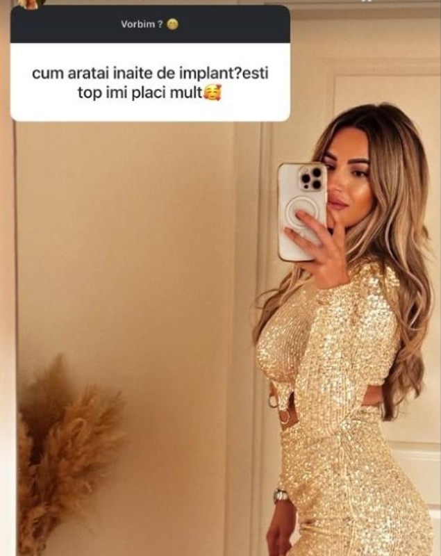 Cum arăta ispita Andreea Aurică - Andrușca de la Insula Iubirii 2025 înainte să își pună implant fesier. Operația estetică nu a făcut-o în România