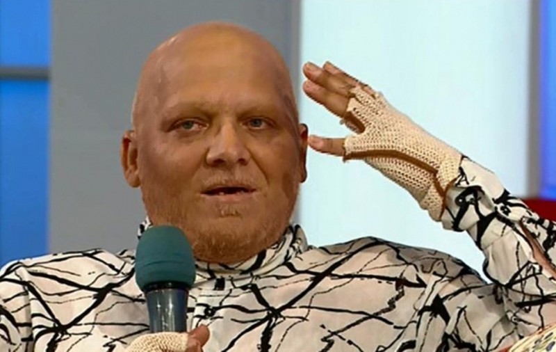 Marian Dârţă, îngenuncheat de durere de când i-a recidivat cancerul: "Nu mai pot nici să plâng"