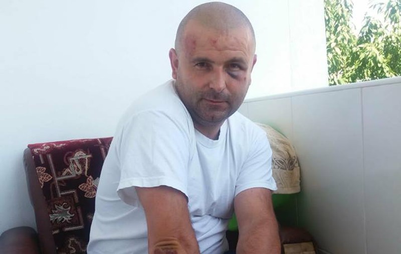 Un polițist din Piatra Neamț a fost bătut și lăsat fără încărcător. A primit pumni în cap pentru ca pistolul să nu ajungă la agresori