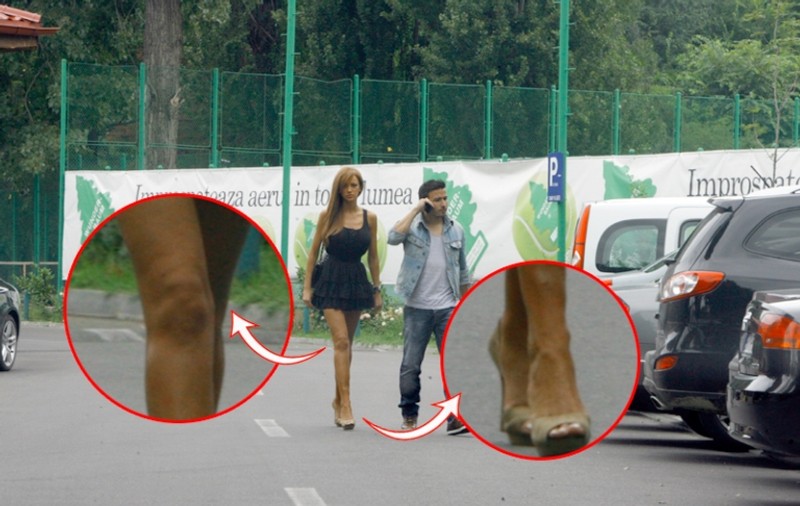 IMAGINEA care SPULBERĂ mitul divei! Bianca Drăgușanu, plină de răni și de celulită! FOTO