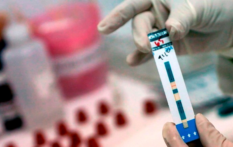 Virusul HIV, eliminat cu ajutorul transplantului de celule stem