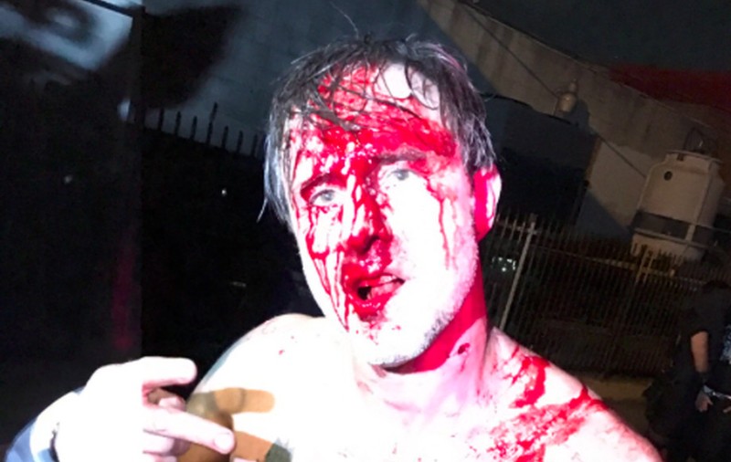 Actorul David Arquette, bătut măr într-un meci de wrestling. A ajuns la spital, la un pas de moarte, cu răni grave. Scene interzise minorilor | FOTO&VIDEO
