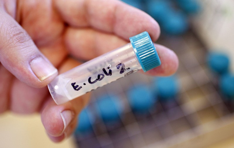 Bacteria E-Coli, depistată în 69 de probe de carne și brânză, în magazine din mai multe județe