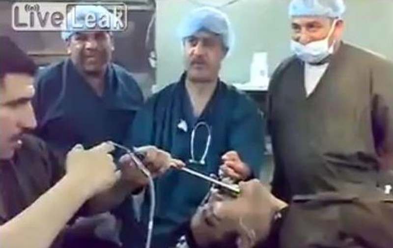 De necrezut! Uite ce au găsit doctorii în stomacul acestui pacient! | VIDEO