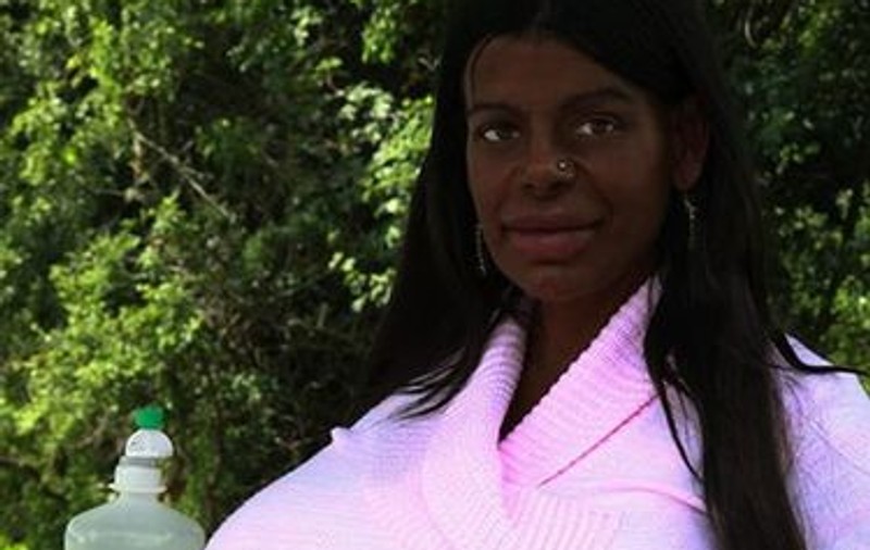 Și-a dorit întotdeauna ca pielea ei sa fie neagra asa ca a stat săptămâni întregi în solar și și-a injectat melanina pana a ajuns sa arate asa!