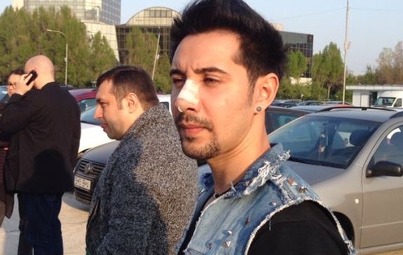 Adi Cristescu a apărut la ZU Music Awards CU NASUL PANSAT