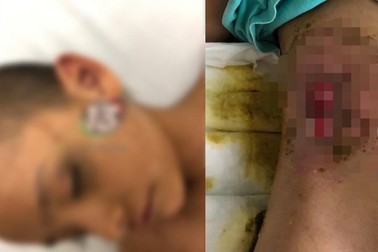 Yaz a ajuns în stare critică la spital. Foto: Procuratura Puebla