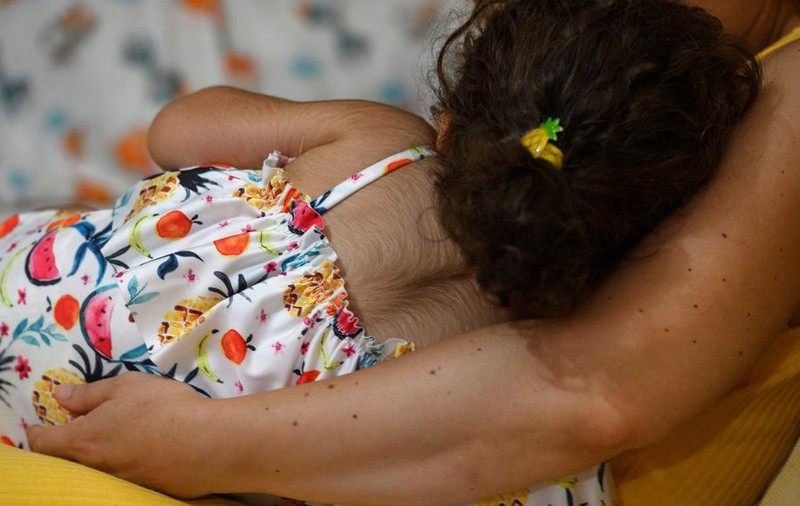20 copii din Spania au păr pe tot corpul, după ce li s-a dat din greșeală un medicament de creștere a părului pentru dureri de stomac