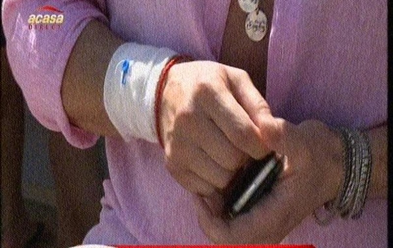 Cătălin Botezatu, cu branula în mână pe plajă