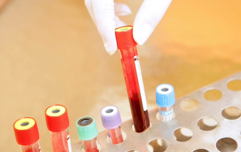 Rusia va impune examinarea medicală obligatorie a străinilor și amprentarea acestora. Ce pățesc cei care nu respectă noile reguli
