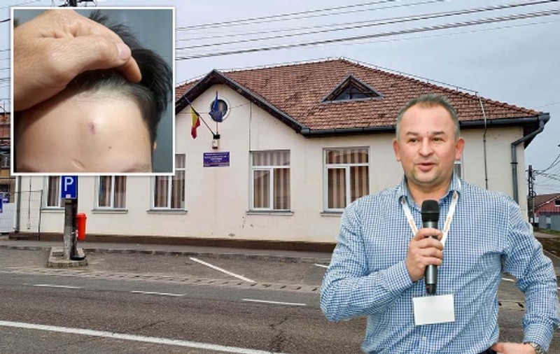 Un profesor bihorean este acuzat că i-a spart capul unui elev de clasa a VI-a: „Nu exagerați, e doar o zgârietură”. Sorin Ban a fost suspendat și este cercetat disciplinar