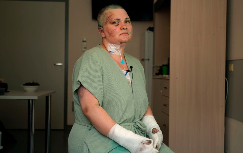 Jurnalista de la Novaia Gazeta bătută crunt promite că va continua să meargă în Cecenia, în ciuda amenințării lui Kadîrov că o „va distruge”