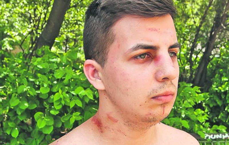 «Poliţiştii m-au călcat în picioare» - FOTO