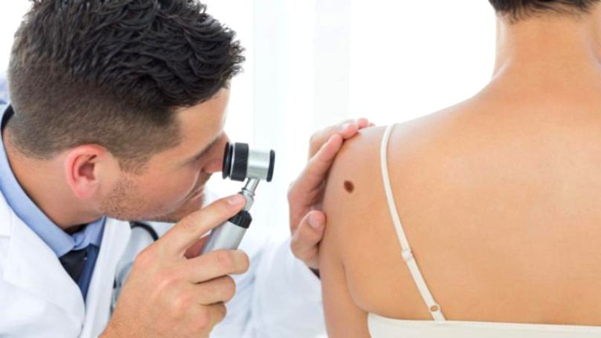 Mihaela Leventer. Medic dermatolog care verifică o aluniță