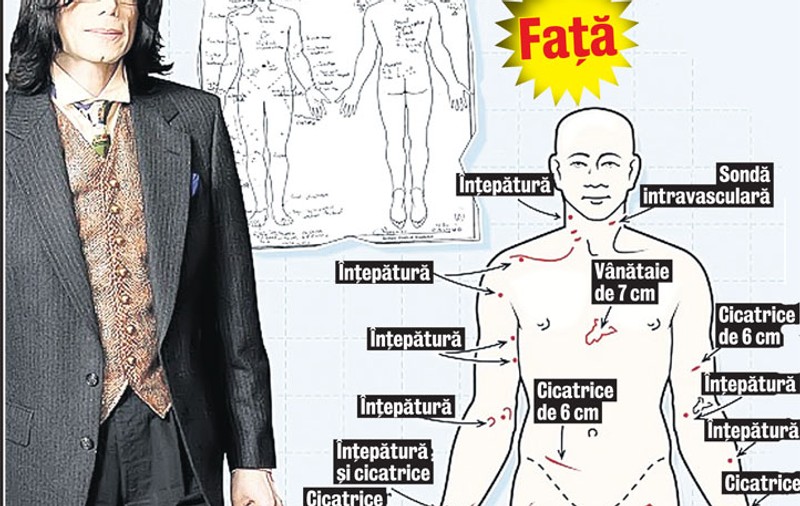 Michael Jackson avea pielea ciuruită!