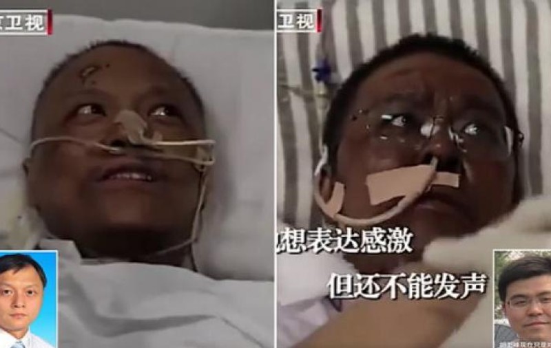 Unul dintre medicii chinezi a căror piele s-a înnegrit din cauza tratamentului pentru coronavirus a murit, celălalt s-a recuperat