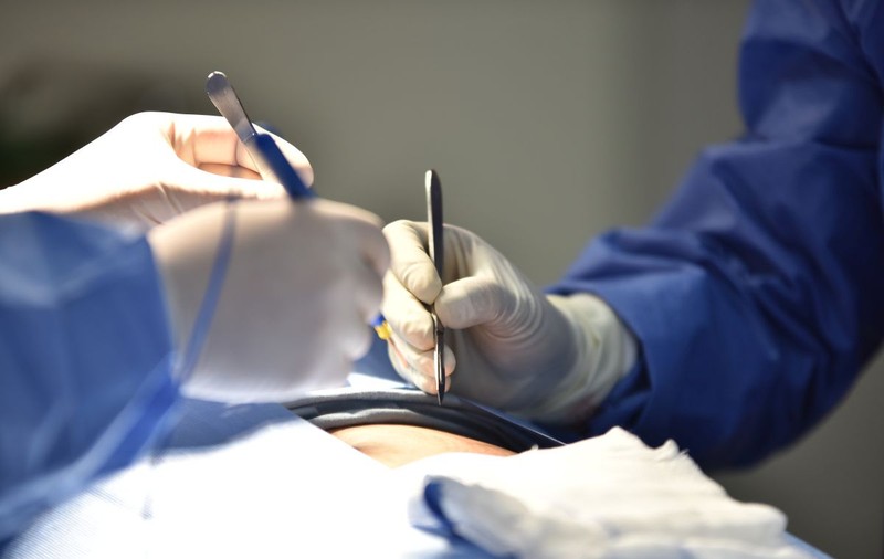 Primul transplat de inimă robotică din lume, făcut cu succes într-un spital din Arabia Saudită. Cine este pacientul | VIDEO