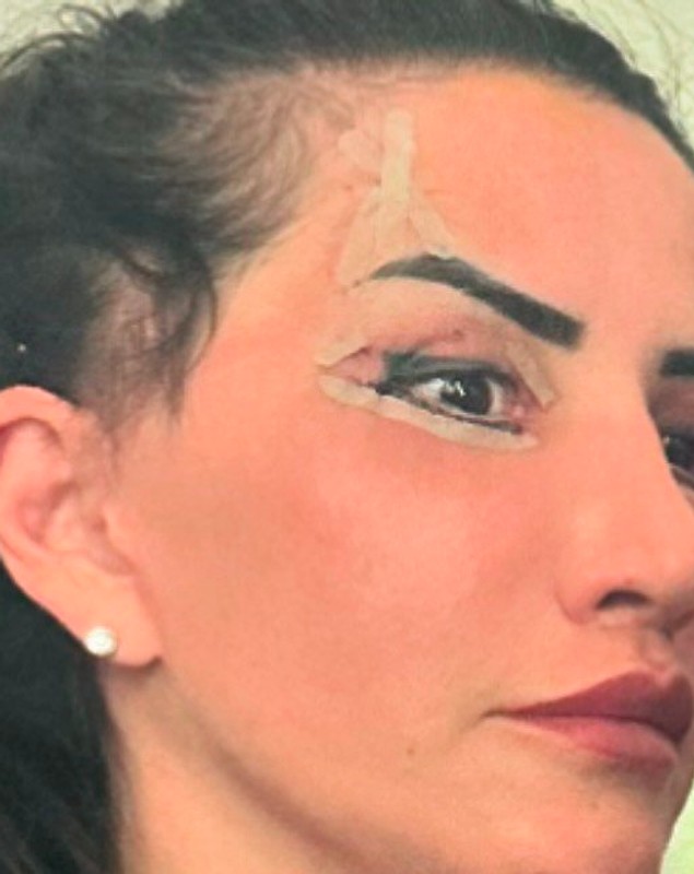 Mara Bănică, o nouă intervenție estetică la față: „A durat o oră și jumătate și a costat 3.200 de euro”. Ce procedură și-a făcut