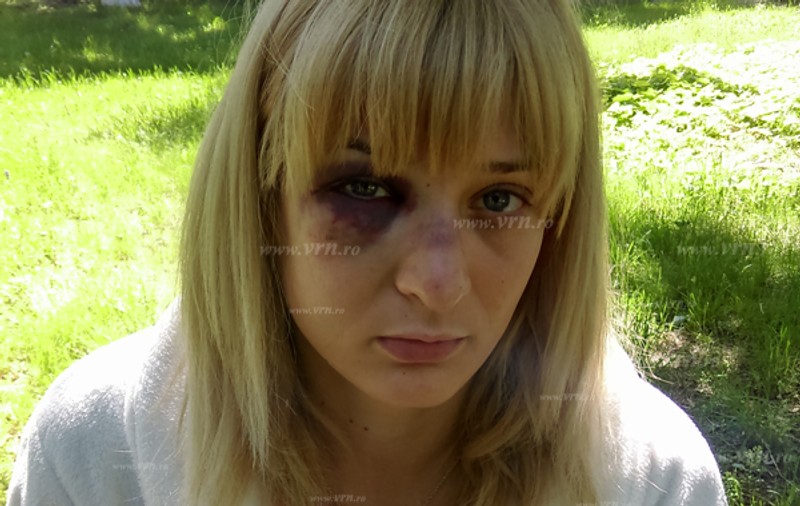 Femeie bătută de fostul soț în județul Vaslui. Uluitor cum a fost salvată tânăra de la moarte