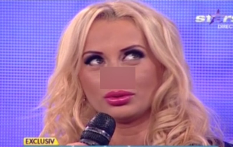 CUM ARATĂ Simona Trașcă, DUPĂ A PATRA OPERAȚIE LA NAS | FOTO