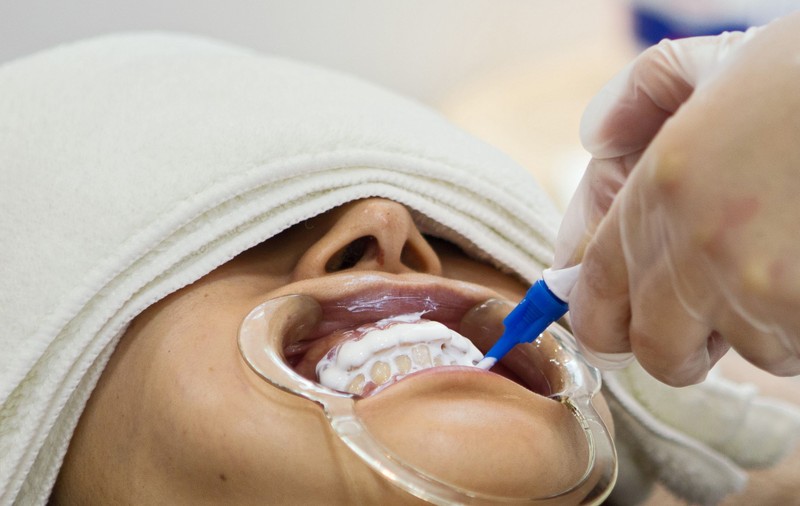 Şi-a lipit toată viaţa dinţii cu superglue pentru că se temea de dentist. Cum arată dantura femeii VIDEO