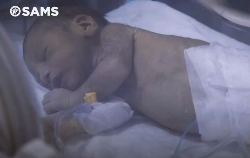 O mamă și bebelușul ei au fost salvați de două ori în trei zile, după cutremurul care a devastat zone din Turcia și Siria