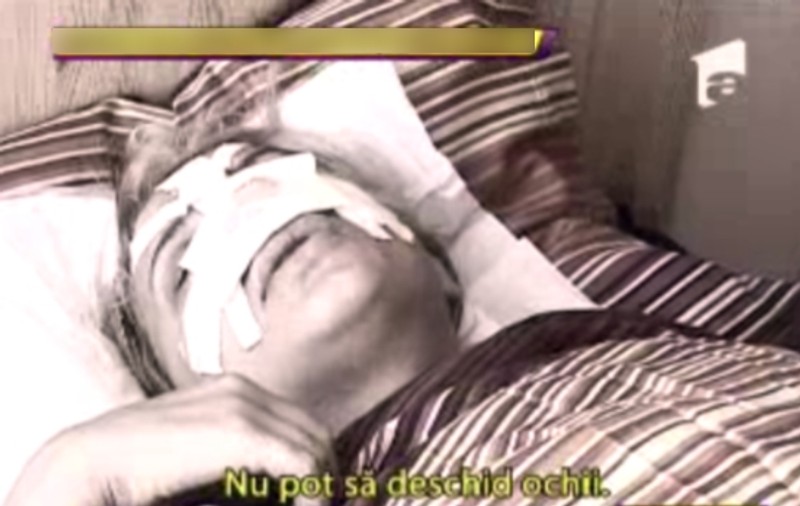 O vedetă de la noi, COMPLET DESFIGURATĂ, pe patul de spital: "Mă sufoc!". O recunoşti?