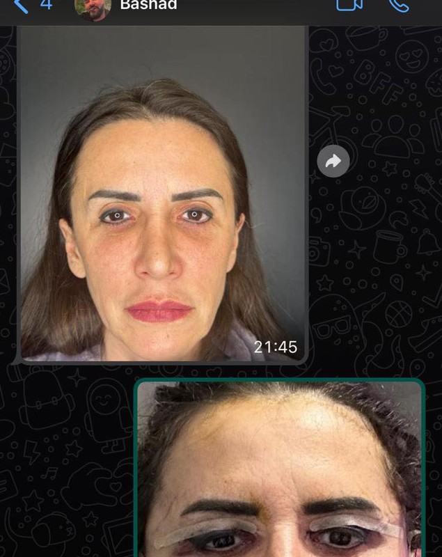 Cum arăta Mara Bănică înainte de liftingul facial. Motivul pentru care a apelat la medicul estetician: „Nu mi-a fost rușine cu cine sunt”