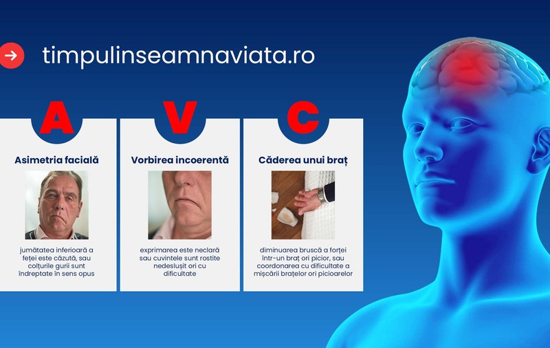Accidentul vascular cerebral, o urgență medicală majoră
