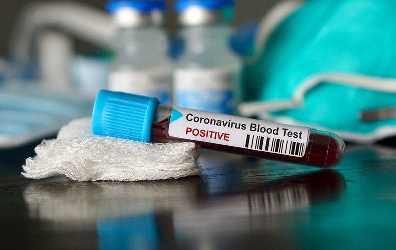 Lista oficialilor de rang înalt care au fost infectaţi cu coronavirus