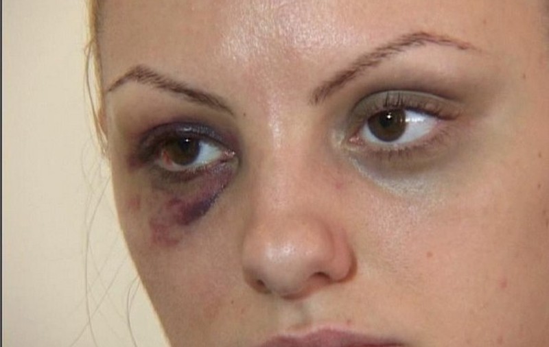 ELE AU FOST "IUBITE" CU PUMNUL! Vezi care sunt VEDETELE BĂTUTE de PARTENERII DE VIAŢĂ