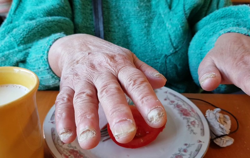 VIDEO | Povestea impresionantă a bătrânei care a dormit 6 ani în parc, până i-au degerat mâinile şi picioarele