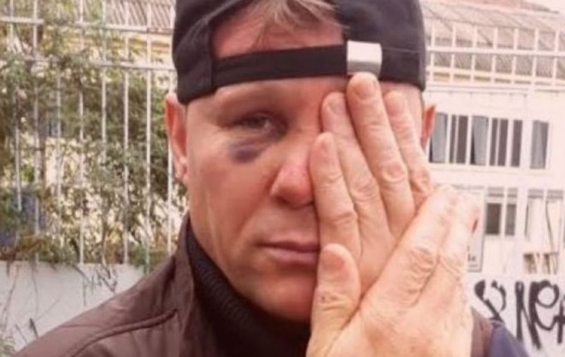 Un român a devenit erou la Milano după ce și-a riscat viața pentru a-și face datoria: "Mi-au dat cu ranga în față, mi-au înfipt o șurubelniță în spate!"