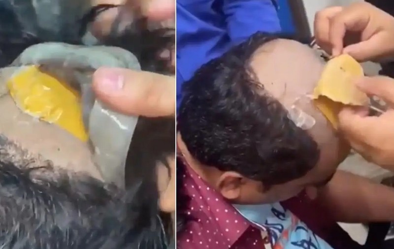 Aur de 40.000 de dolari lipit de cap, sub perucă, de un contrabandist indian chel
