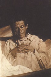 Auguste Deter, prima pacientă diagnosticată cu boala Alzheimer. Foto: Wikimedia Commons